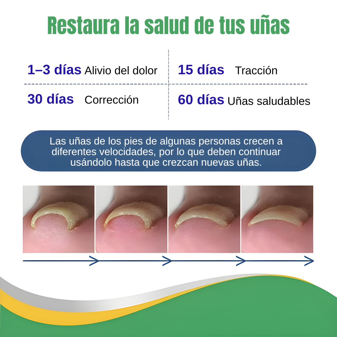 PARCHE CORRECTOR UÑA NANEL – Corrige, protege y recupera la forma natural de tus uñas