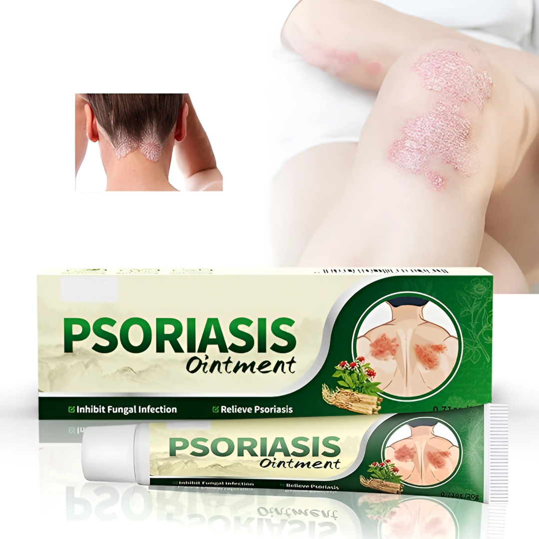 CREMA PSORIASIS UNGÜENTO – Alivio inmediato y cuidado profundo para tu piel
