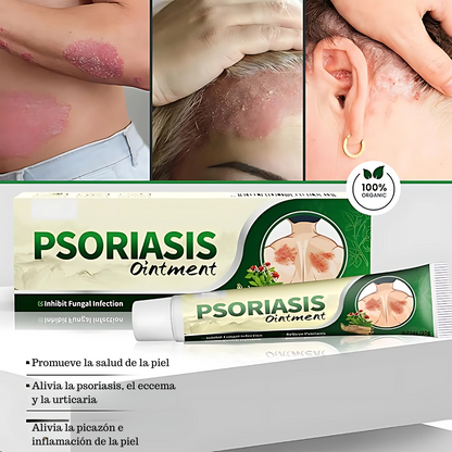 CREMA PSORIASIS UNGÜENTO – Alivio inmediato y cuidado profundo para tu piel