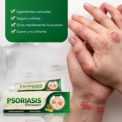 CREMA PSORIASIS UNGÜENTO – Alivio inmediato y cuidado profundo para tu piel